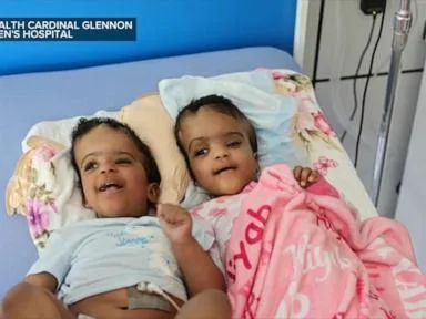 WATCH: Conjoined twins begin new chapter after successful separation